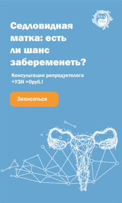 Забеременеть при седловидной матке
